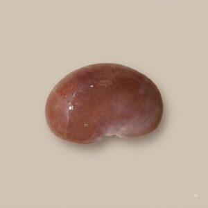 Kidney